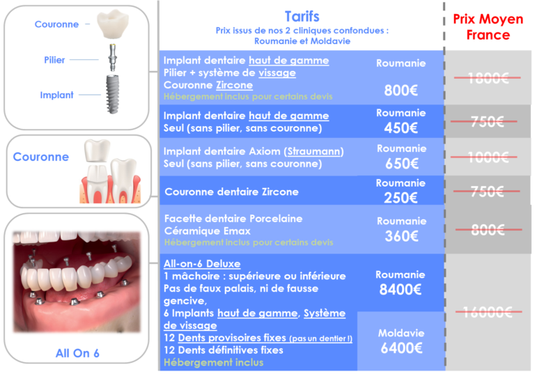 Implant Dentaire En Roumanie Implant 450 Suivi Dentiste En France