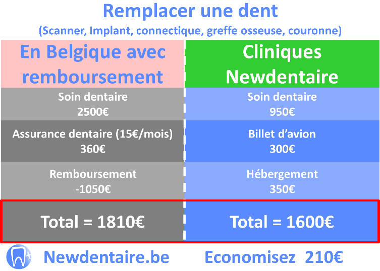 Comparaison du prix implant dentaire remboursé en Belgique Vs cliniques newdentaire