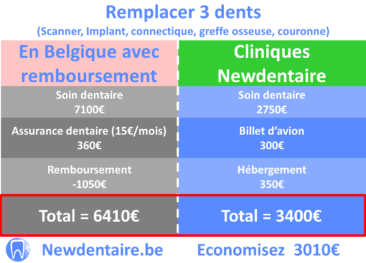 Comparaison du prix pour 3 implants dentaires remboursés en Belgique Vs cliniques newdentaire