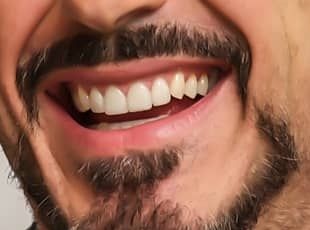 Votre sourire après le soins dentaire en Roumanie