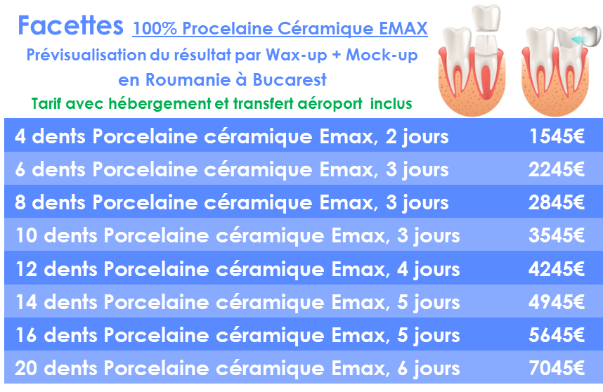 Prix Facette dentaire céramique en Roumanie