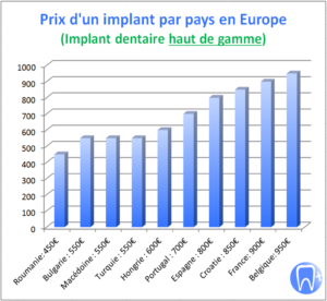 Graphique du prix d'un implant dentaire par pays en Europe