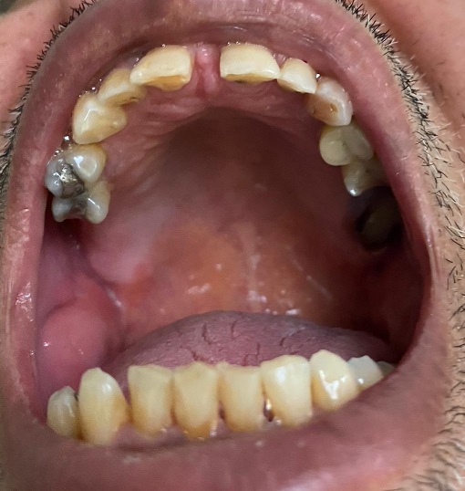 Photo dentition 1