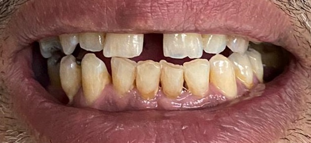 Photo dentition 3