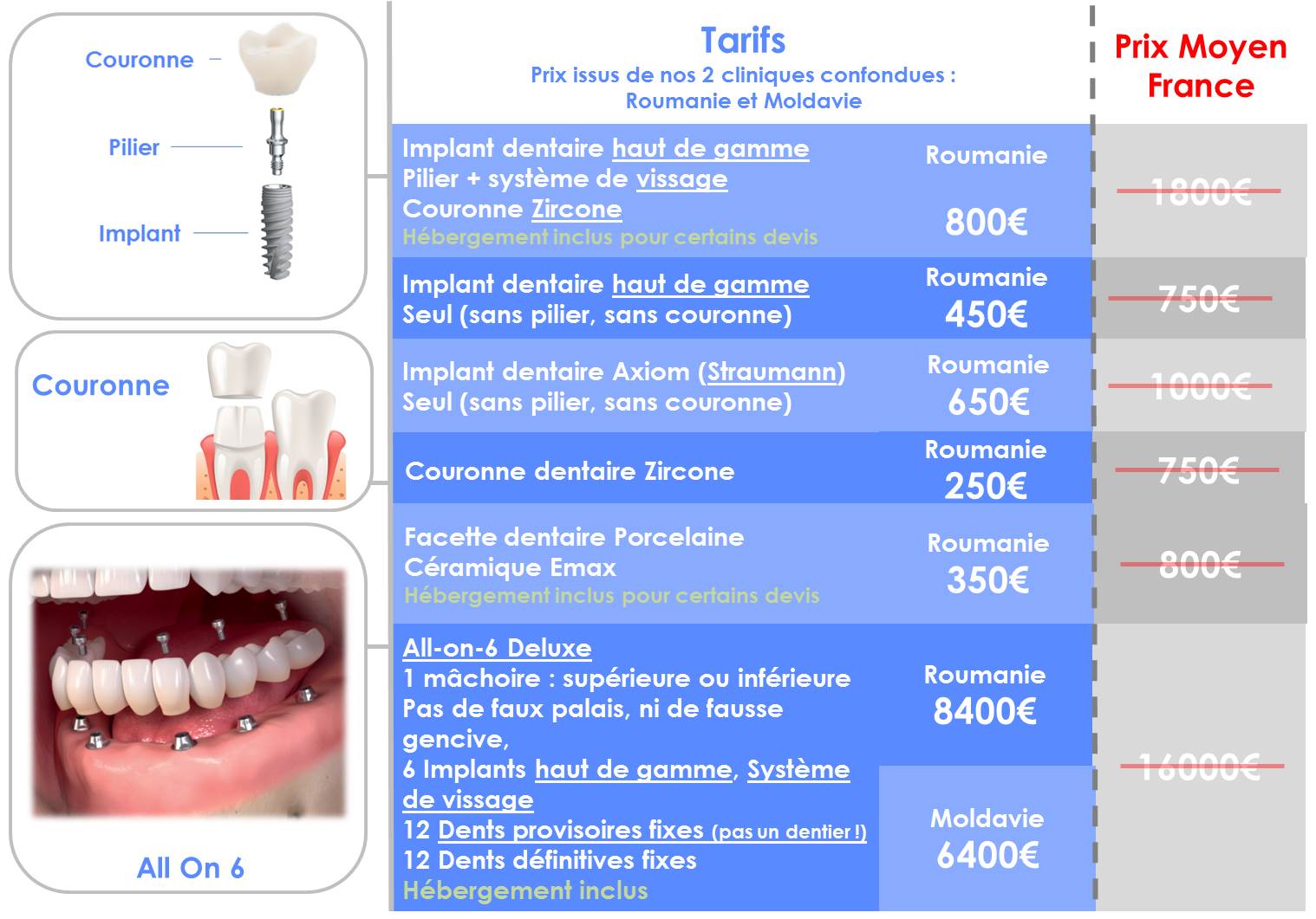 Dental Implant Abroad Newdentaire implant dentaire en Hongrie et