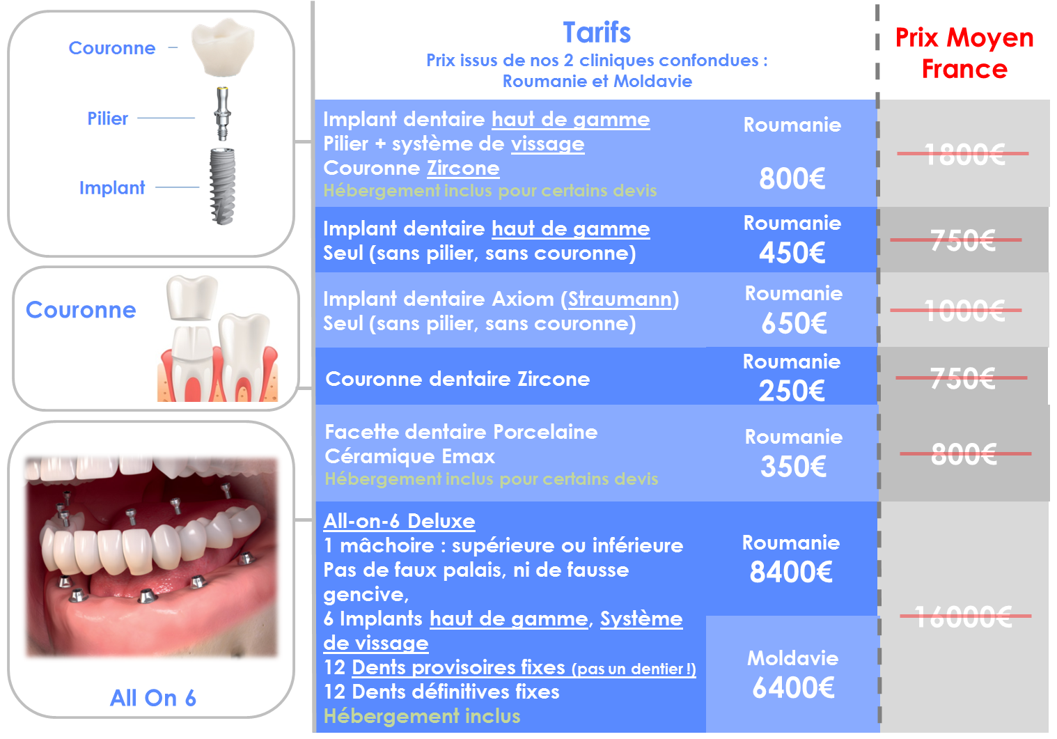 Implant dentaire en Roumanie Implant 450€ Suivi dentiste en France Implant dentaire en Roumanie Implant 450€ Suivi dentiste en France