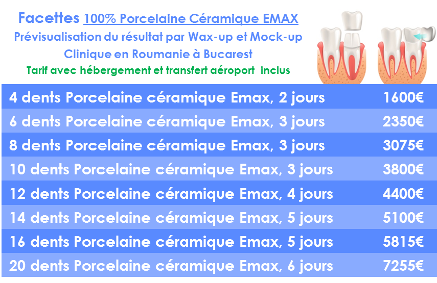Prix Facette dentaire céramique en Roumanie