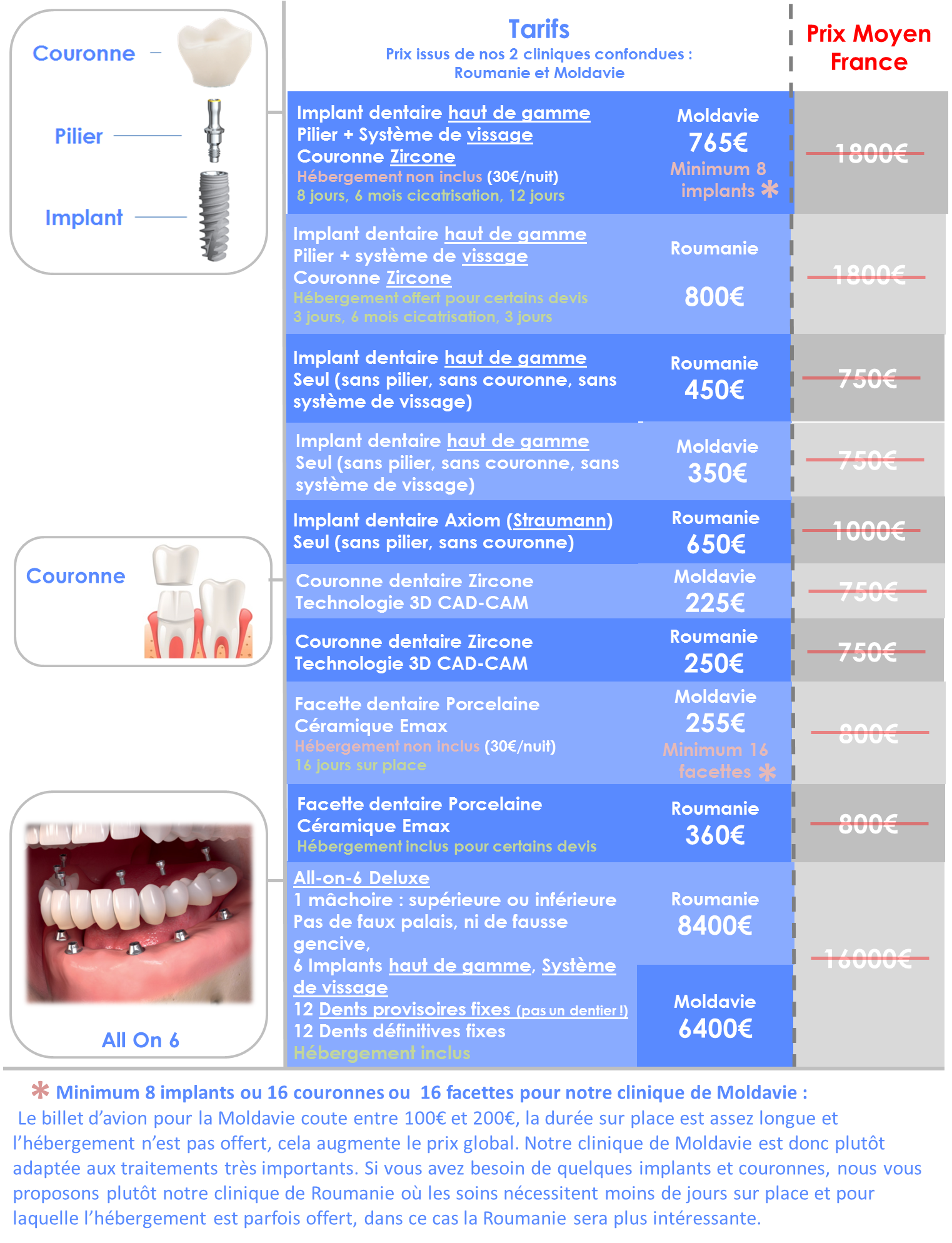 Prix implant dentaire Moldavie