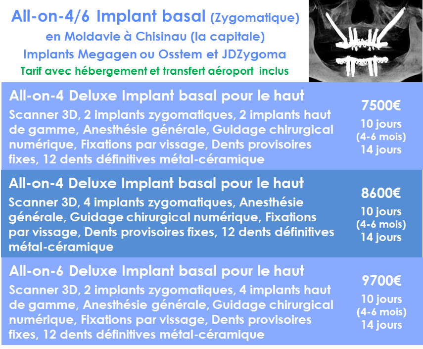 All-on-4-avec-implantologie-basale-Zygomatique