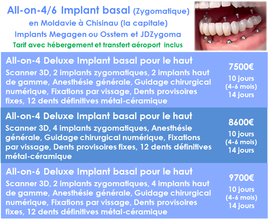 Prix All-on-4 implant Basal