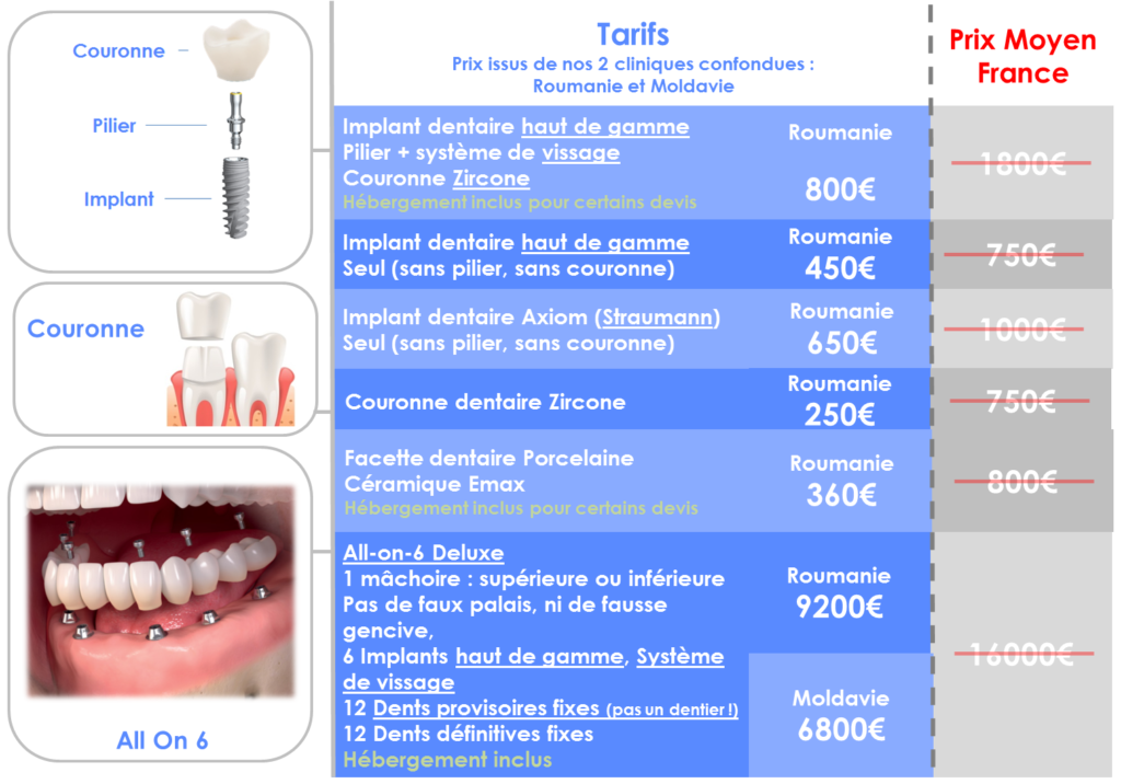 Prix implant dentaire Roumanie