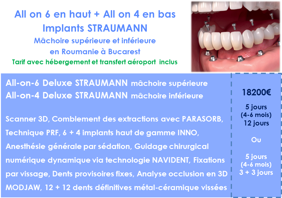 Prix pour refaire ses dents rapidement 10 implants Straumann