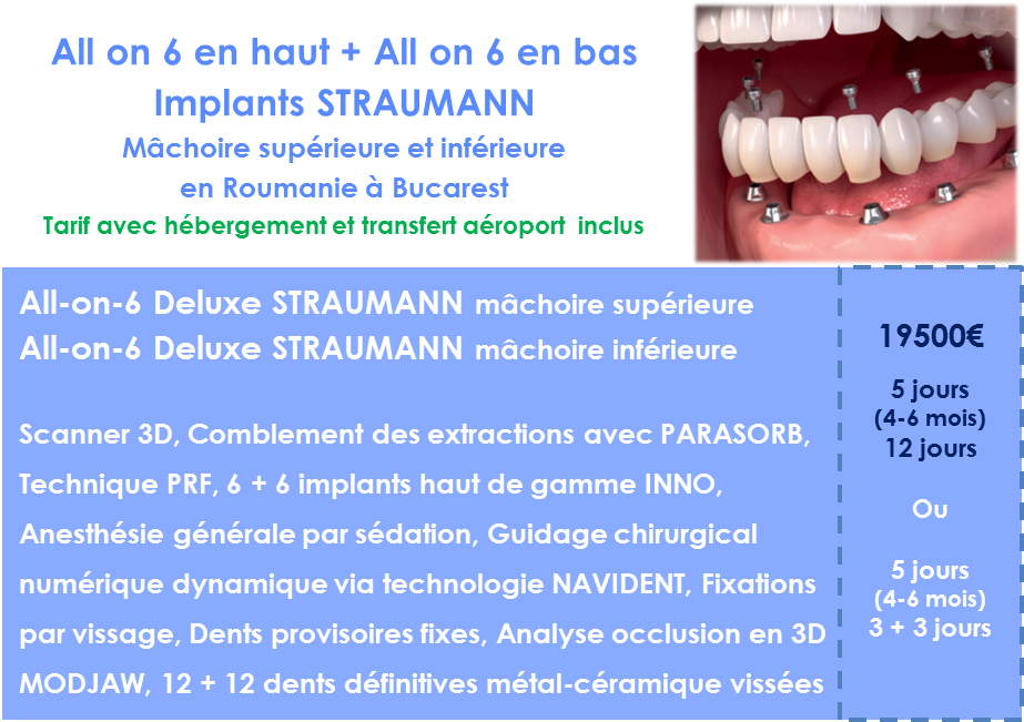 Prix pour refaire ses dents rapidement 12 implants Straumann