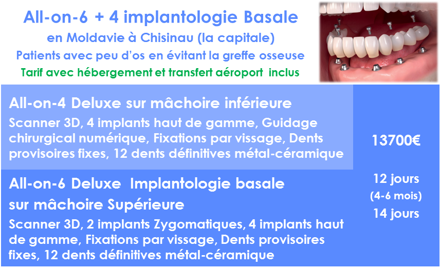 Prix pour refaire toutes ses dents avec 10 implant basale Zygomatique