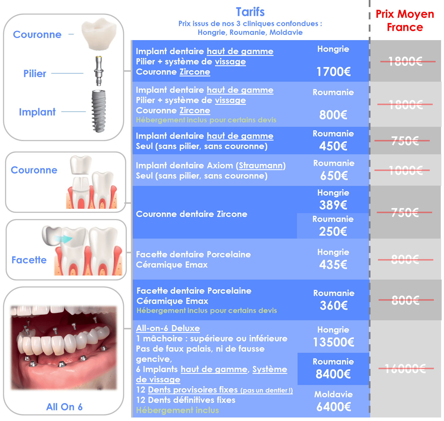 Prix implant dentaire Hongrie Budapest