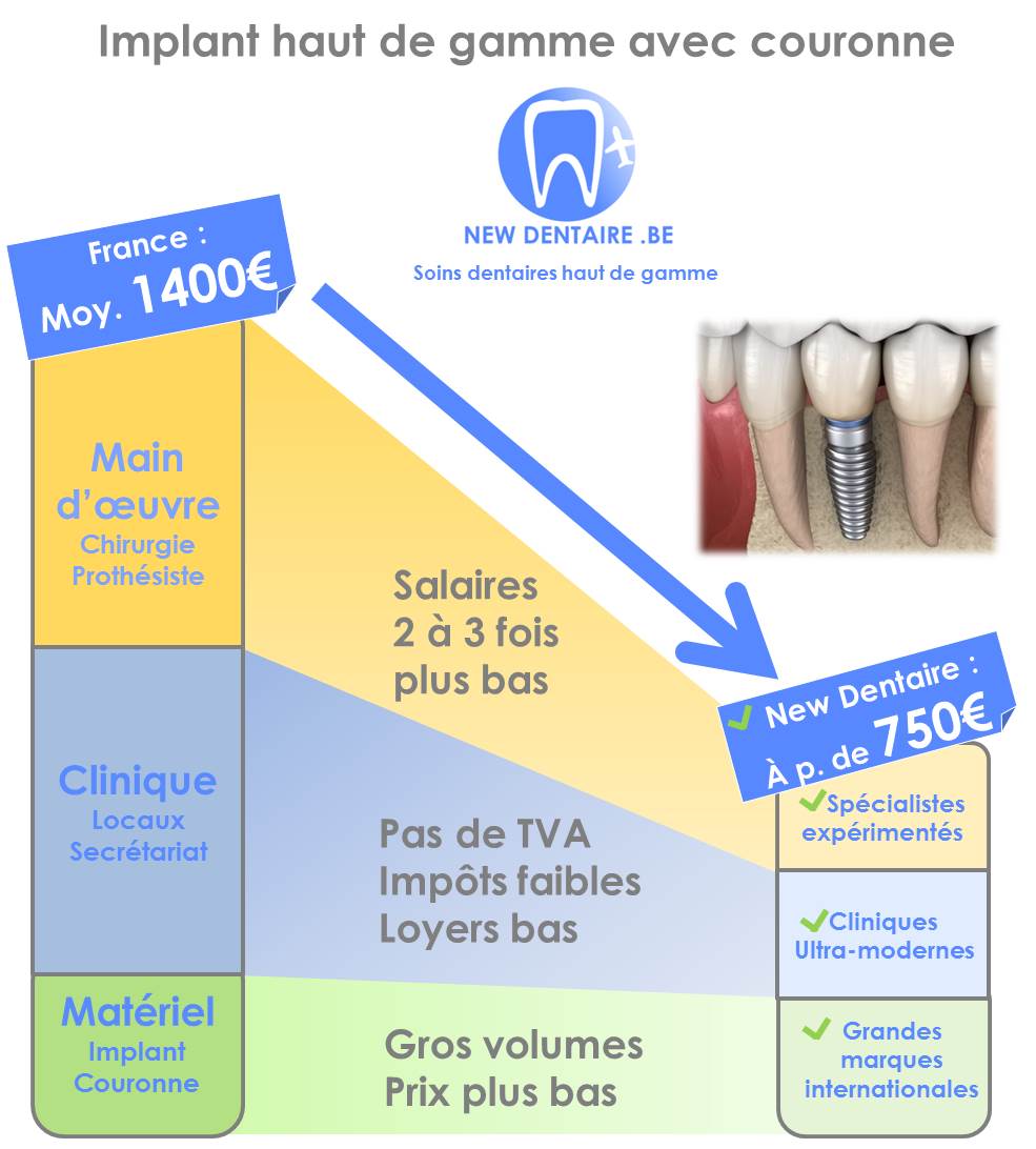 Explication prix implant dentaire moins cher à l'étranger