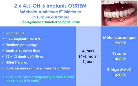 Implant dentaire Turquie bouche complète