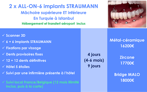 Implant dentaire complet Turquie
