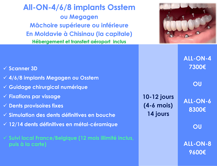 refaire ses dents en Moldavie avec implant Osstem