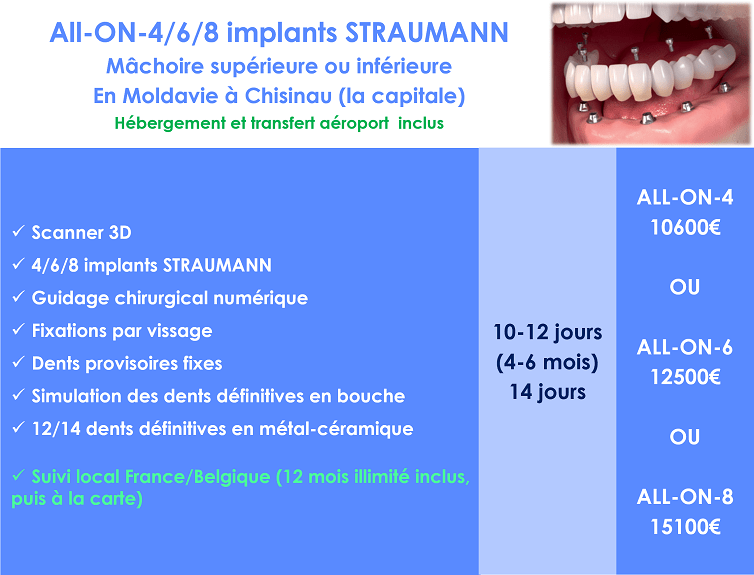 Prix All on 4 implant Straumann