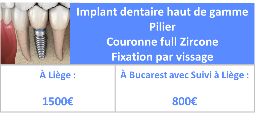 Prix implant dentaire Liège