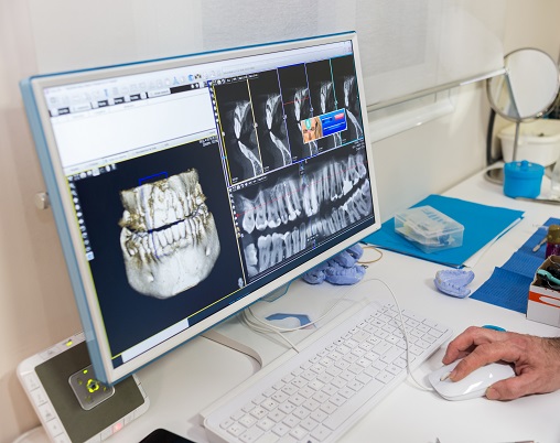 Système numérique 3D et télé-dentisterie
