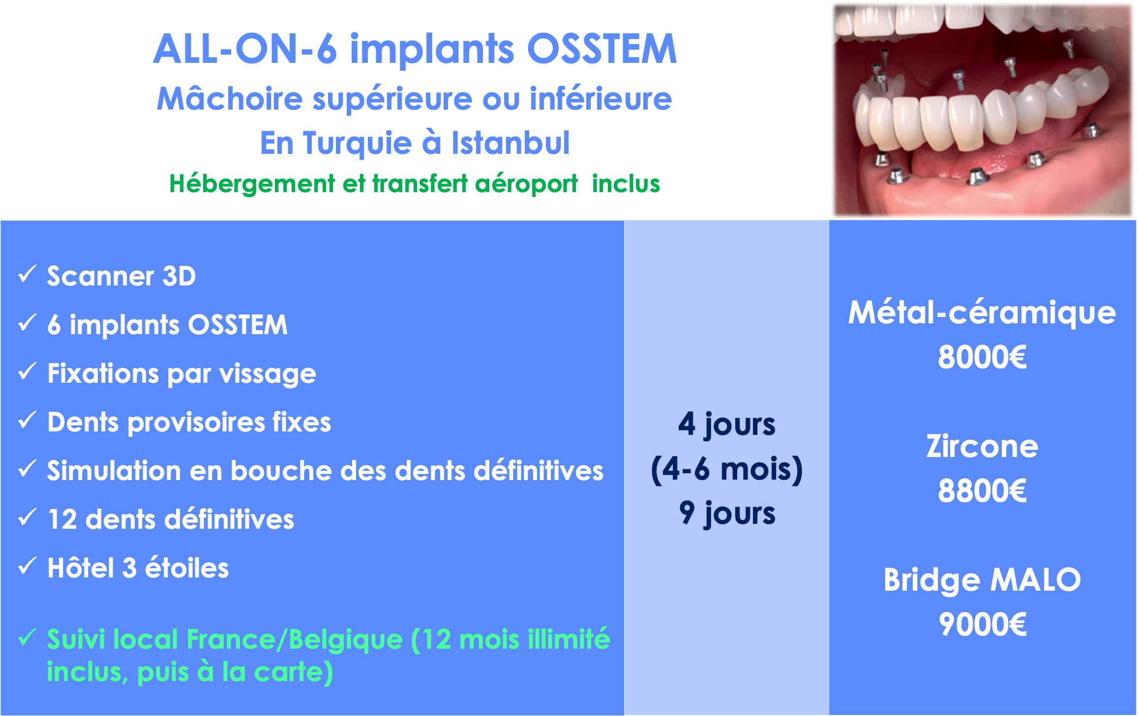 Prothèse dentaire fixe prix - Pose d'implants dentaires - Dentego