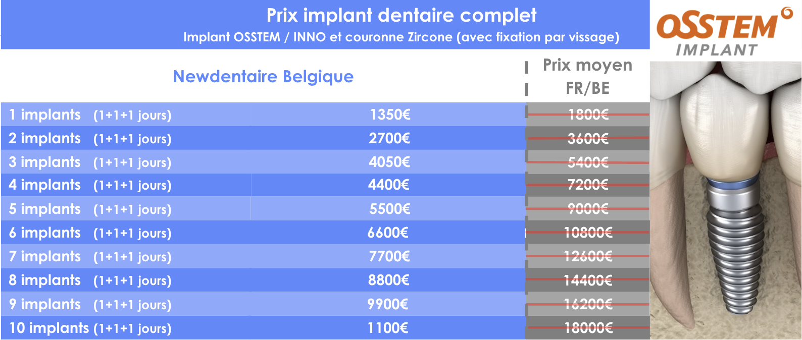 Prix implants dentaires complets BE