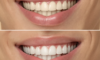 Dents jaunes : causes et solutions efficaces pour retrouver un sourire éclatant