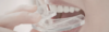 Bruxisme : quelles conséquences pour vos dents et comment les éviter ?