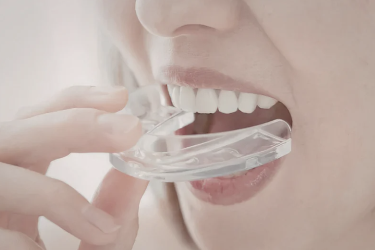 Bruxisme : quelles conséquences pour vos dents et comment les éviter ?
