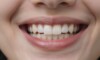 Sourire confiant avec un dentier complet confortable et naturel.
