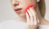 Douleur après extraction dentaire