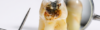 Dent noire : causes, traitements et quand consulter un dentiste