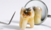 Dent noire : causes, traitements et quand consulter un dentiste