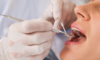 Comment se déroule un premier rendez-vous pour implant dentaire chez Newdentaire ?